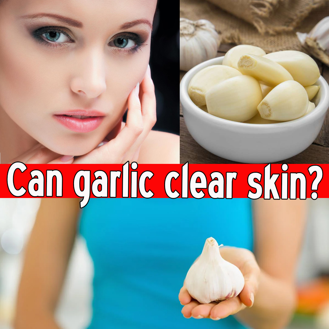 Can garlic clear skin?